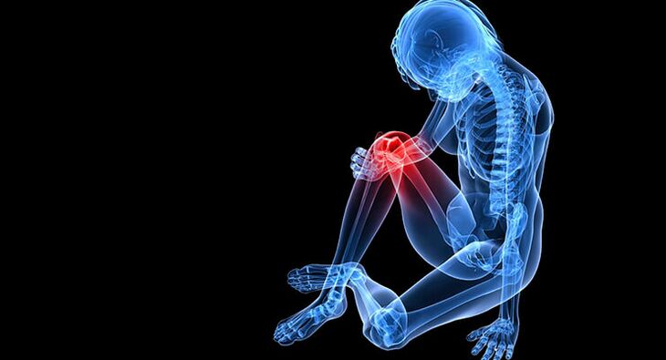Arthrosis