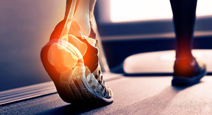 Symptoms of arthrosis