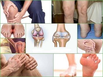How to prevent the development of arthritis and arthrosis