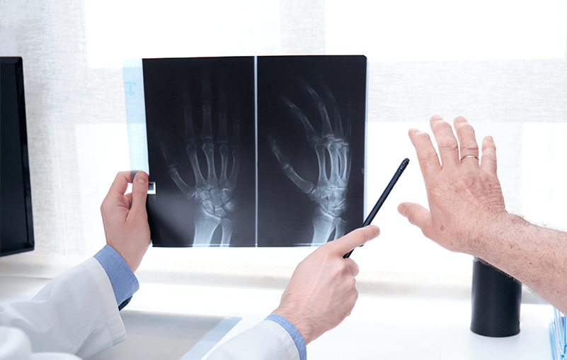 diagnosis of joint arthrosis